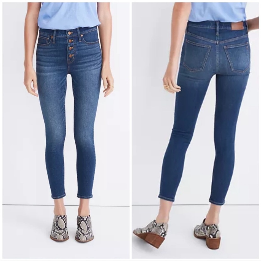 Madewell 9” Mid-Rise Skinny Cropped Button Fly Jeans
